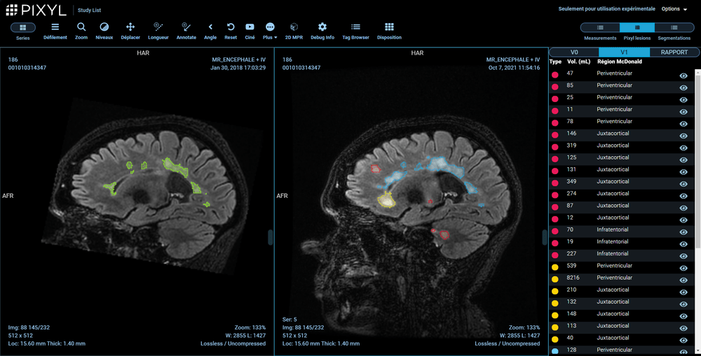 Example of AI in medical imaging. Source: Wiley Analytical Science